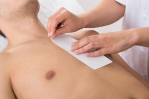 Treatment: Chest / Stomach Hair Removal