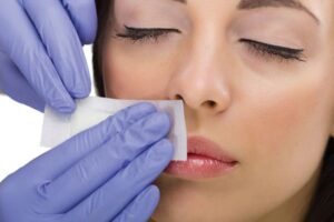 Treatment: Upper Lip Hair Removal