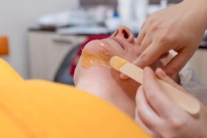 Treatment: Chin Hair Removal